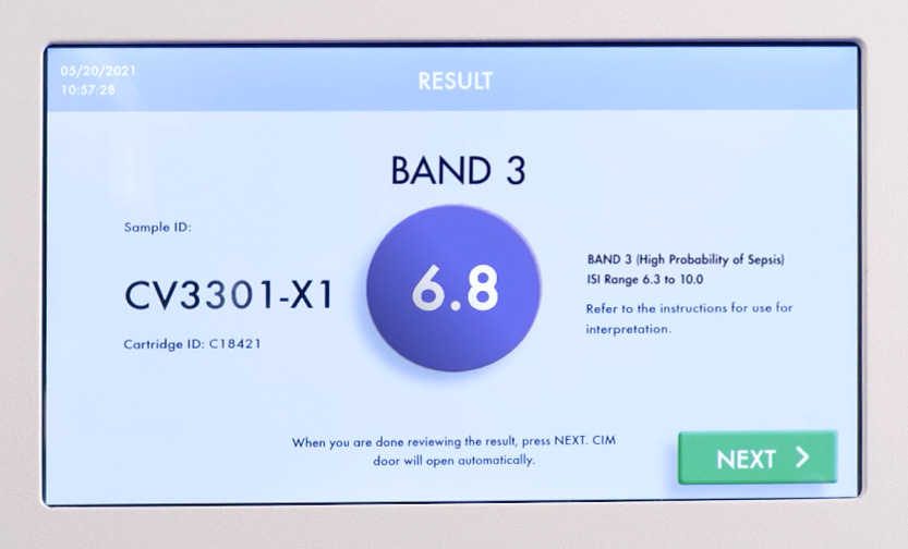 Image-Closeup of Cytovale System result screen