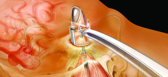 Medical QMS