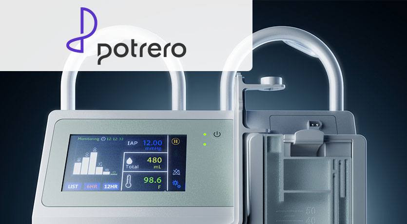 Potrero Customer Story Thumbnail